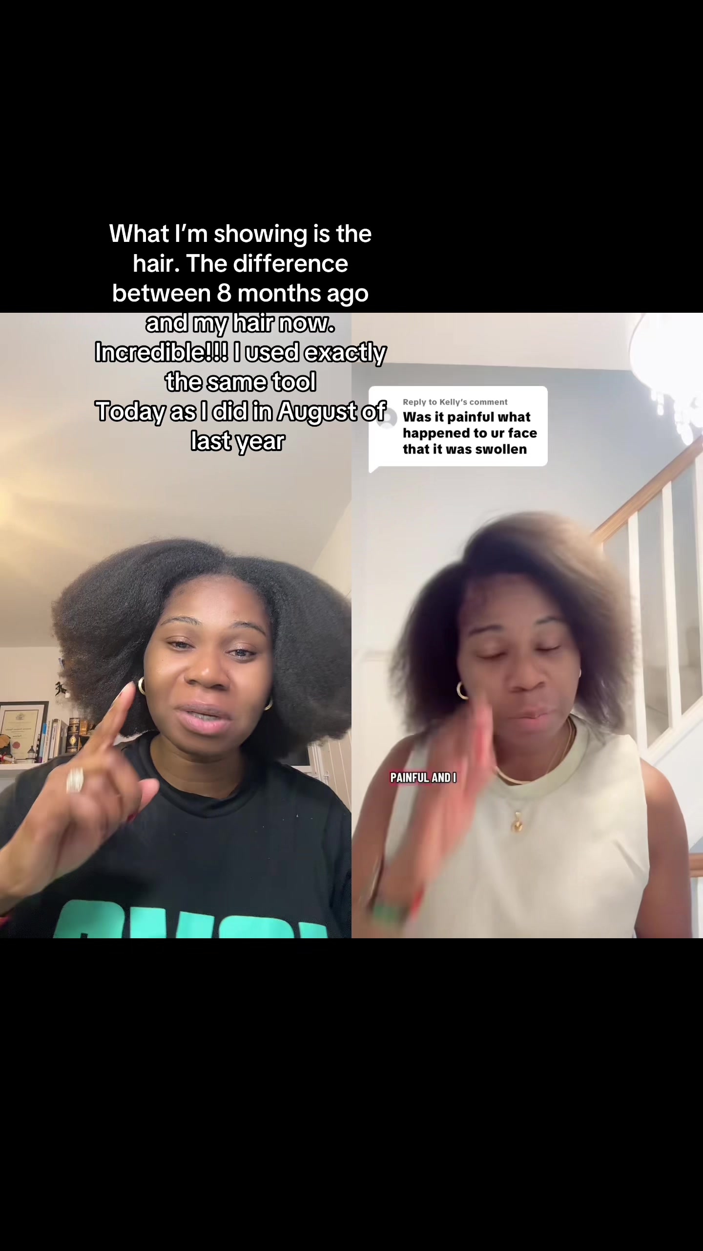 @Myafrotransplant