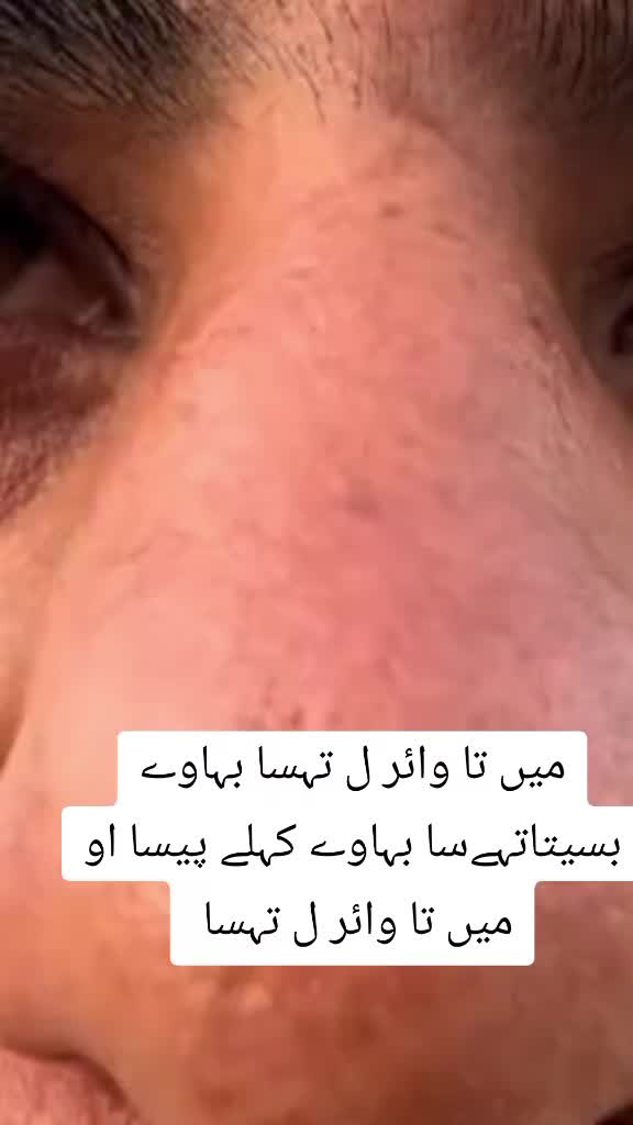 @Kallur ka Don