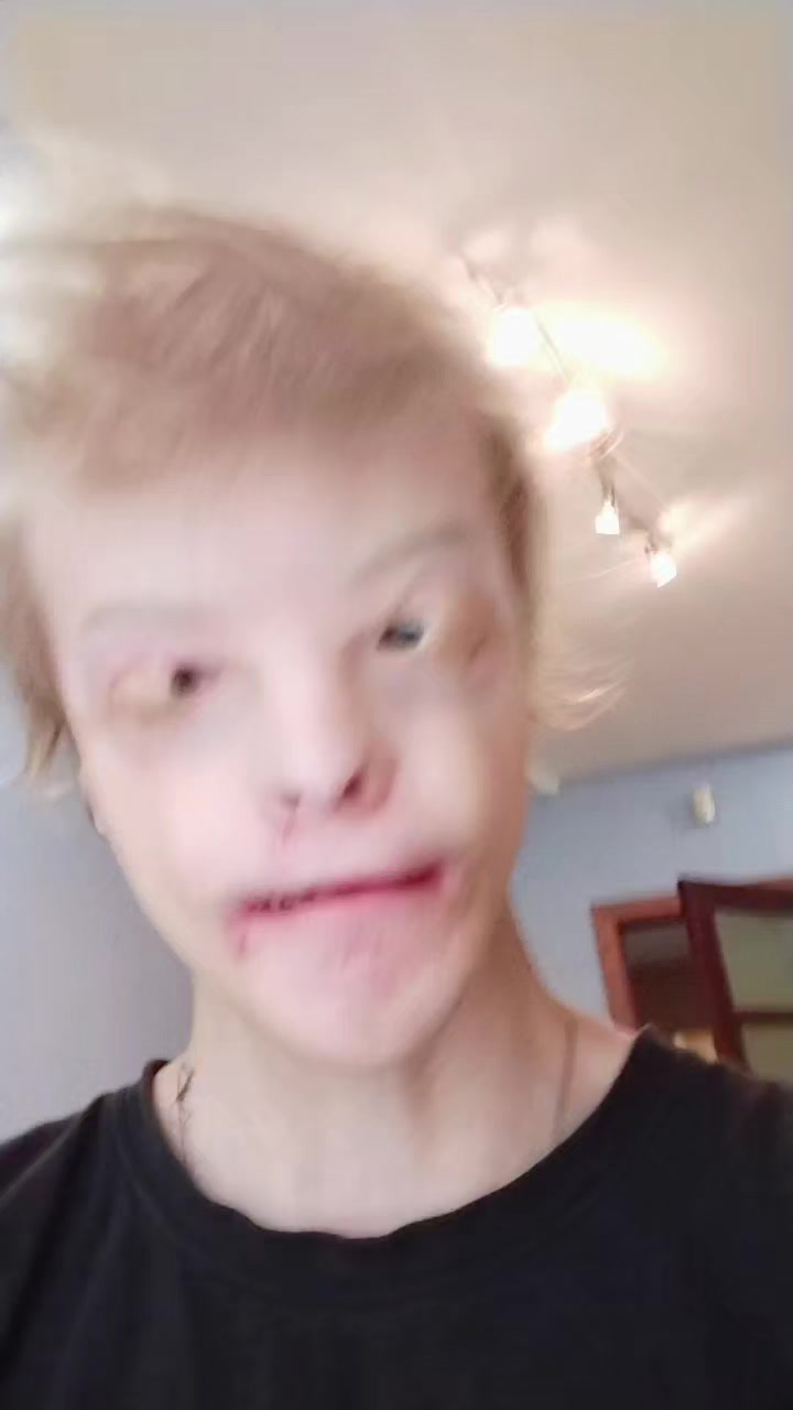 @я scp 008-2