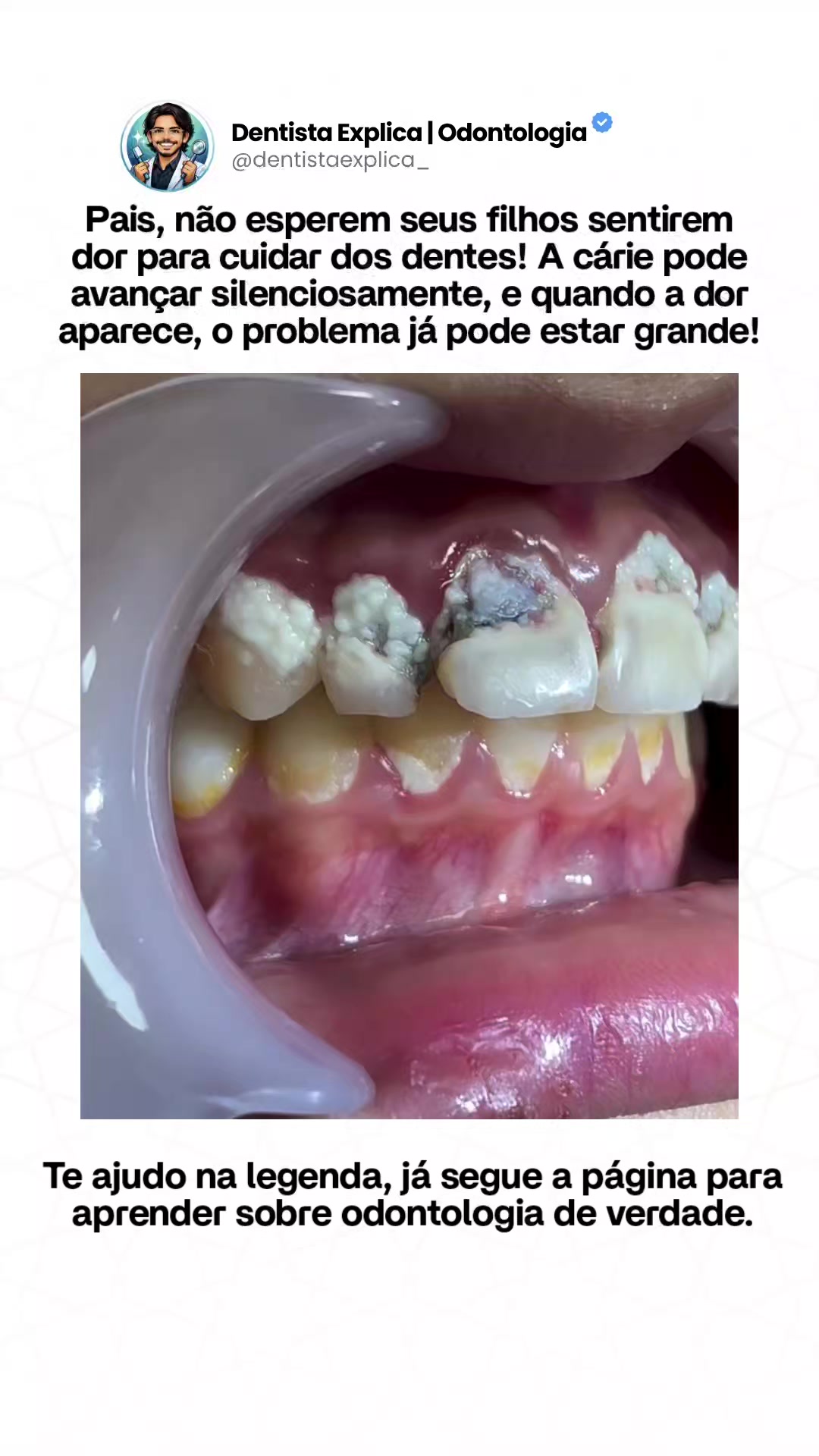 @Dentista Explica | Odontologia