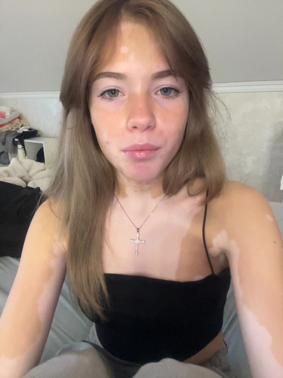 @ТГК: ПЯТНИСТАЯ БРО