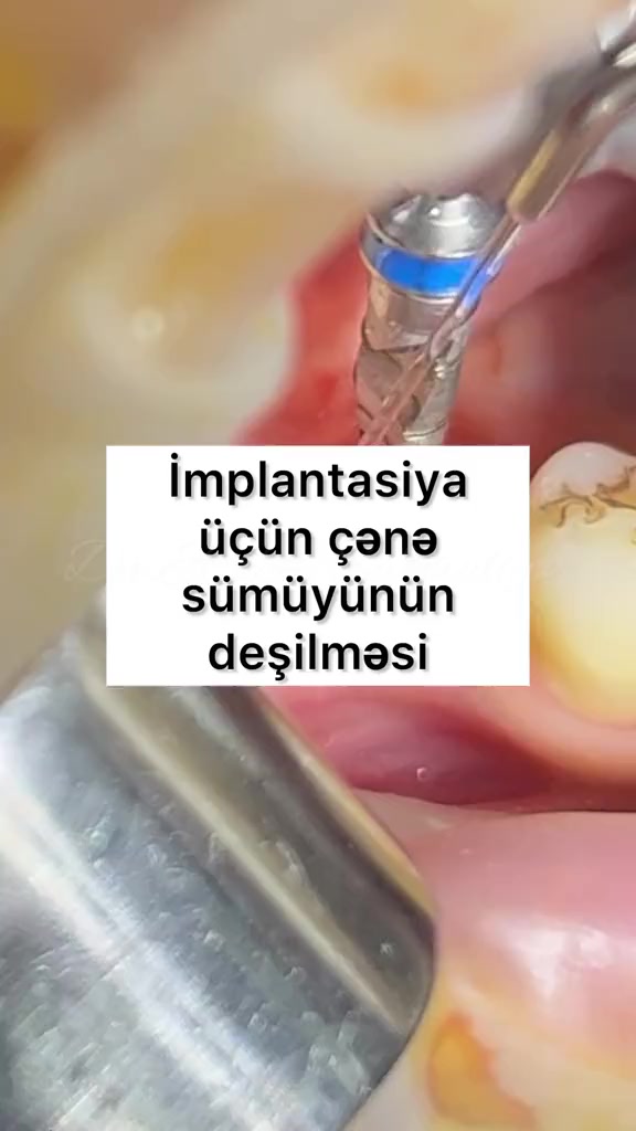 @eltakindentistry