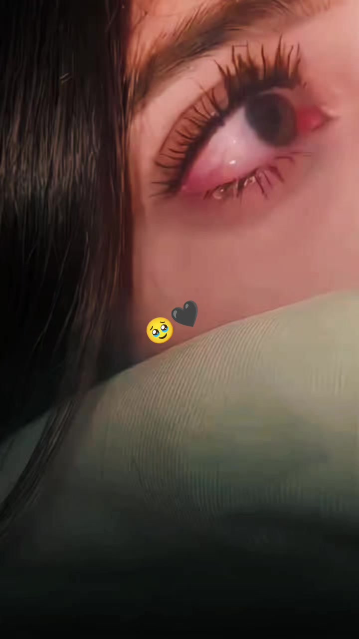 @Alia