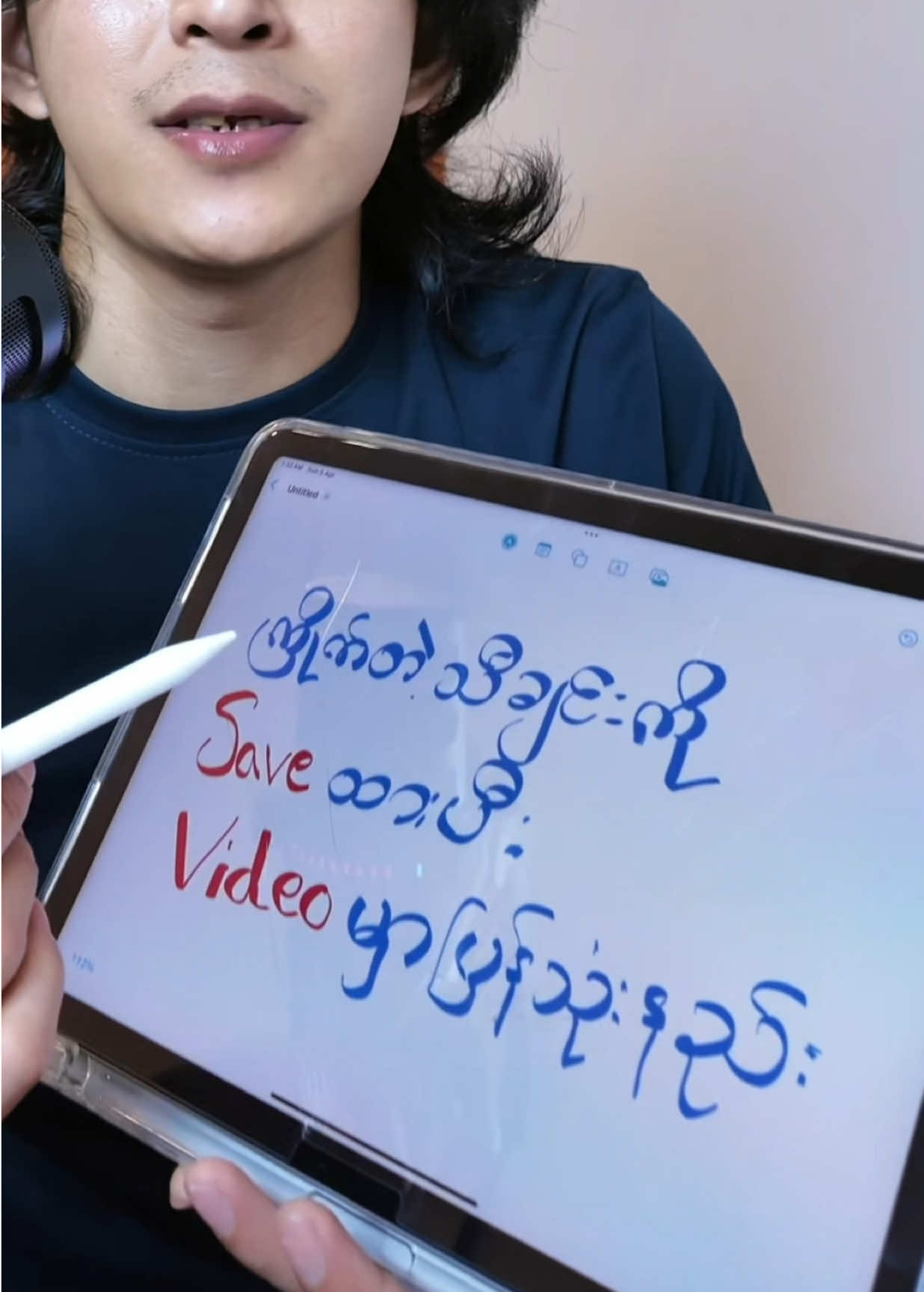 @သွားကျိုး | Edit 📸