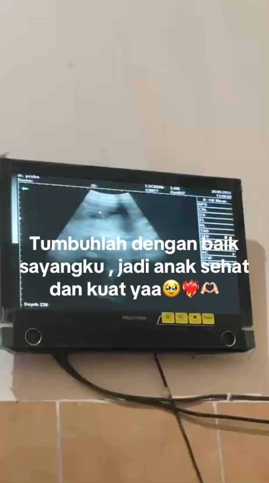 @bbytun