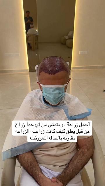 @Dr. Ahmed Alkhateeb