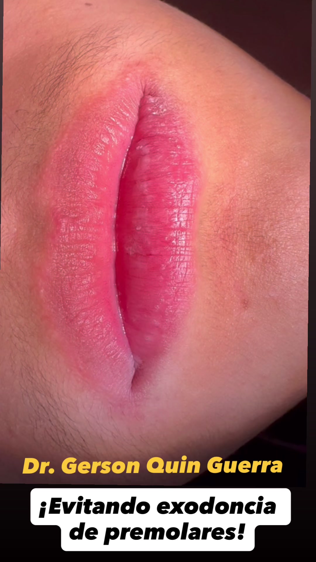 @Dr. Gerson Quin Guerra, PhD