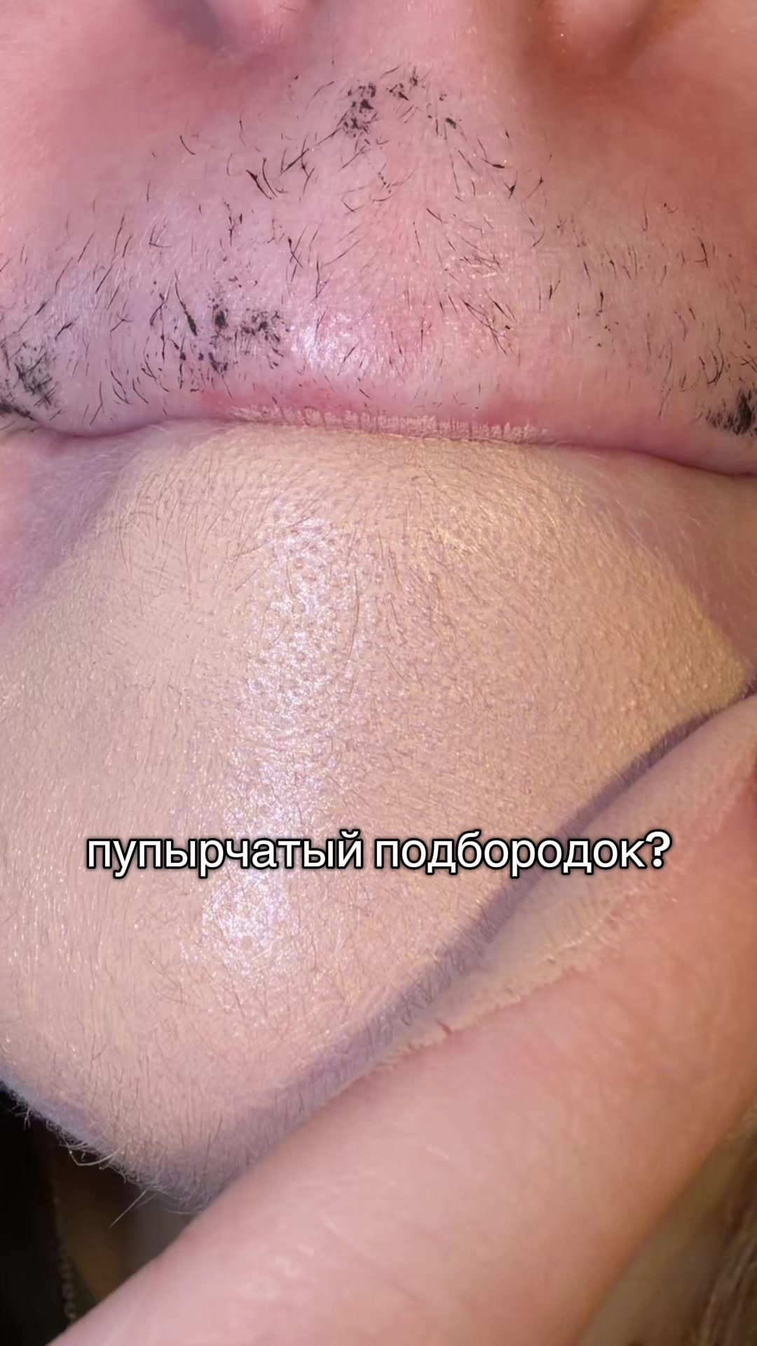 @lipcombovna