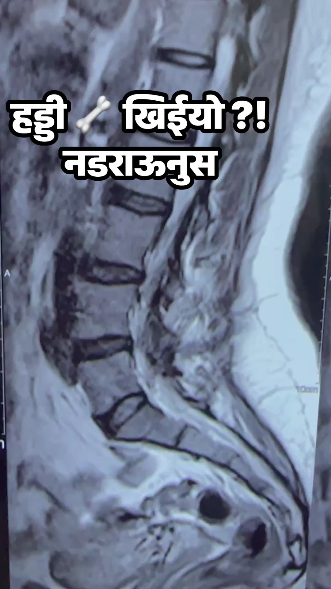 @DrSunil Paudel