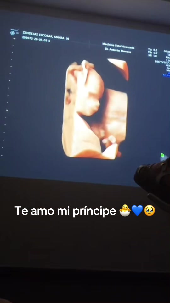 @ZEM&auml;y&icirc;s19