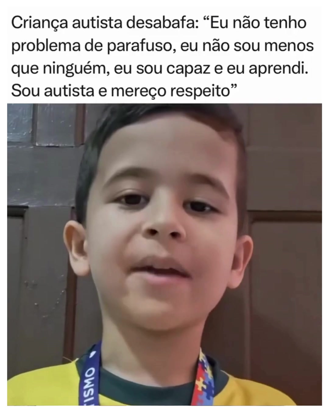 @Alfinetei