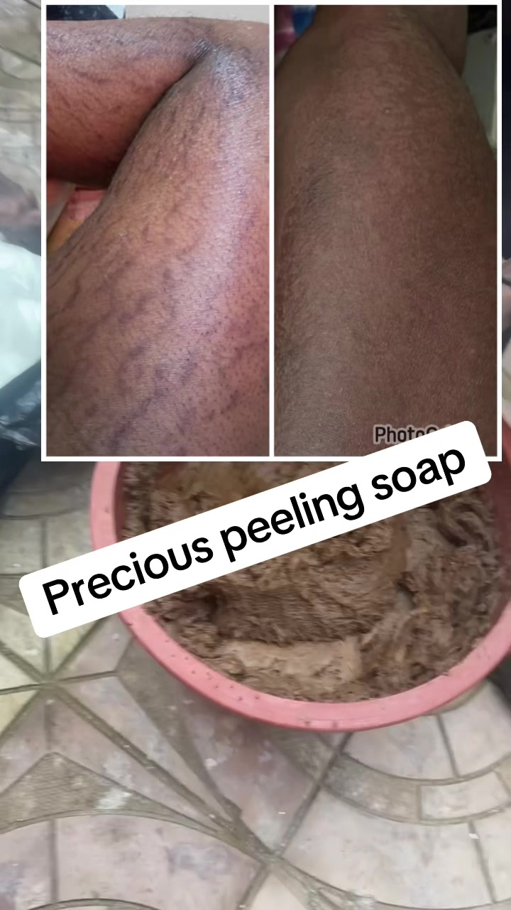 @@ Precious peeling soap