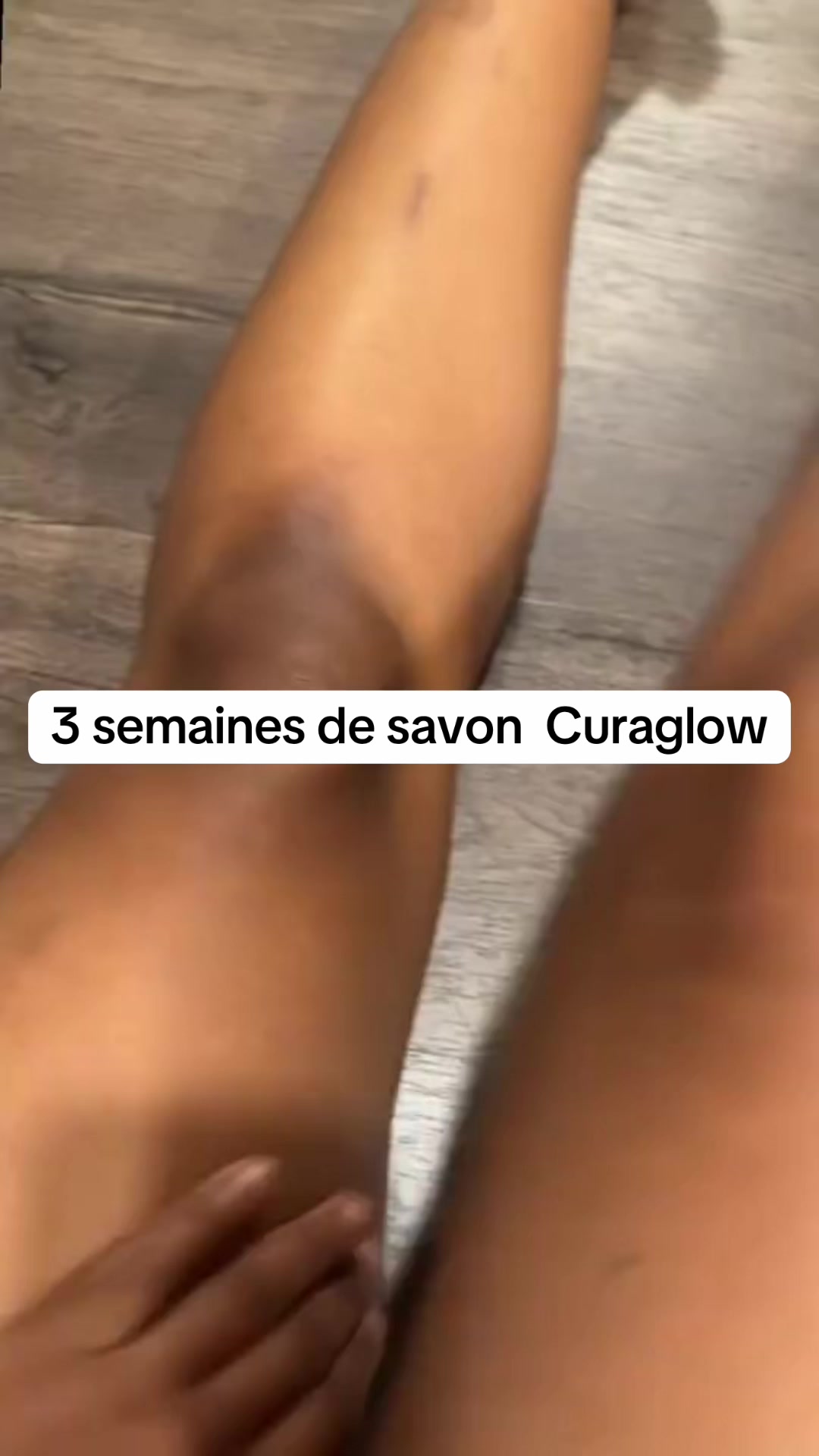 @curaglow