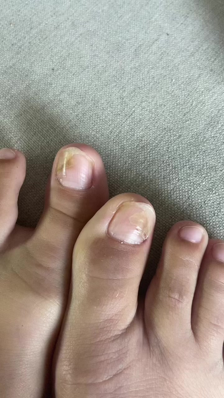 @Carolinaindica