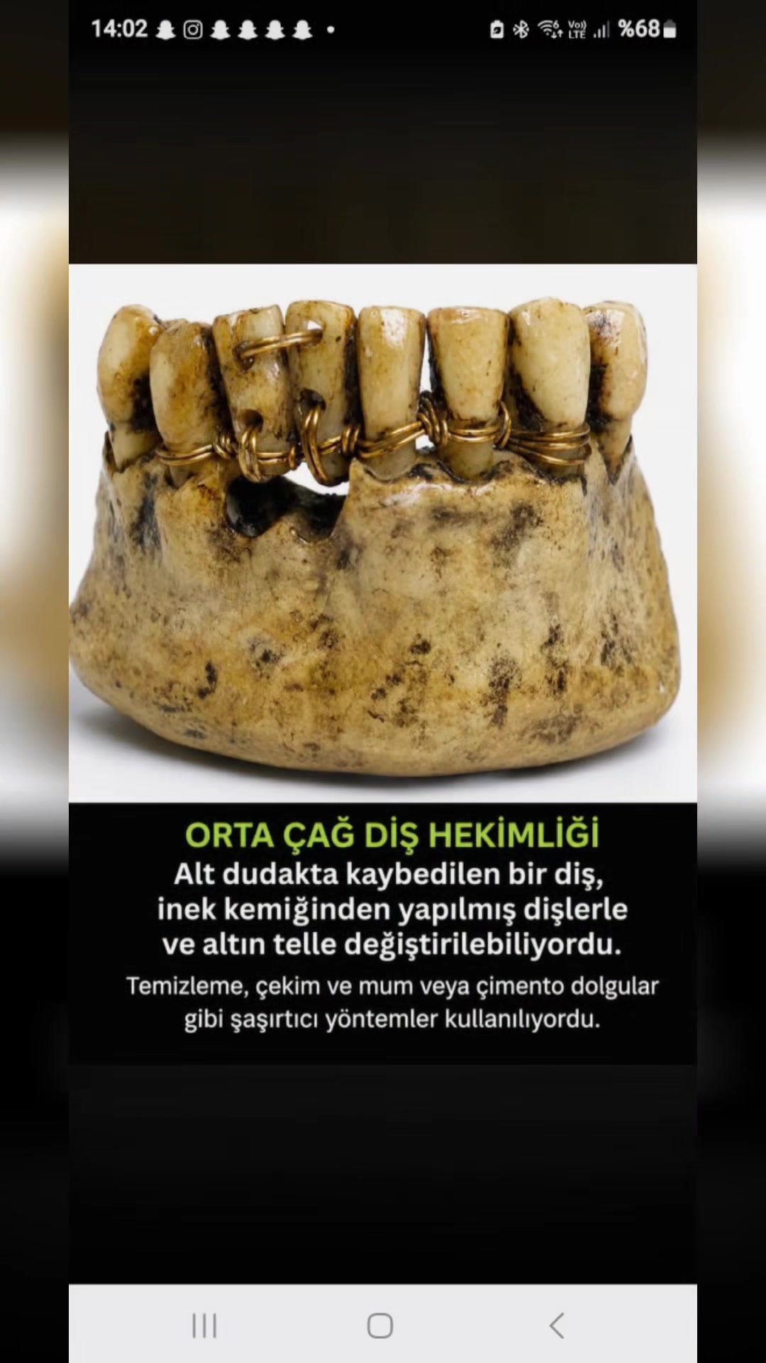 @DişHekimi Fikret Altan Dentist