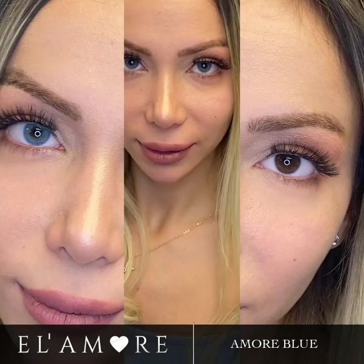 @ლინზა