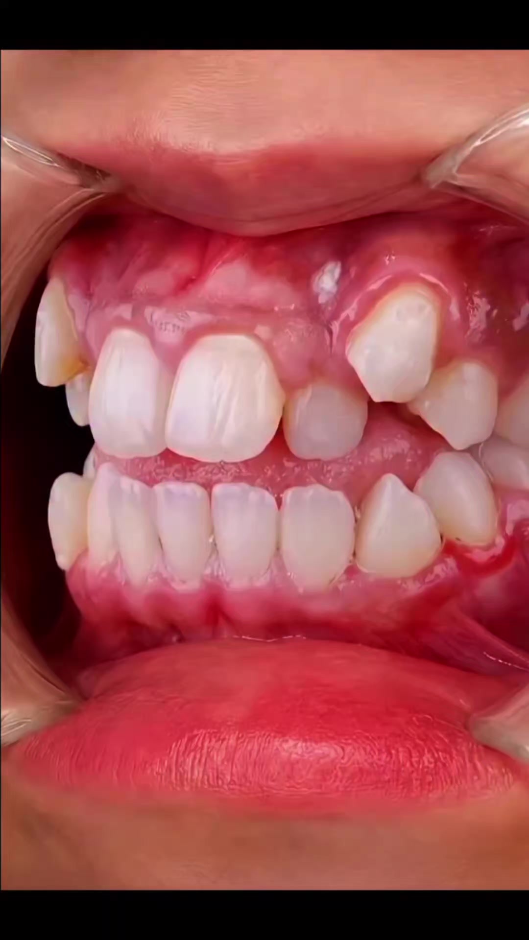 @MAX DENTAL CLINICS