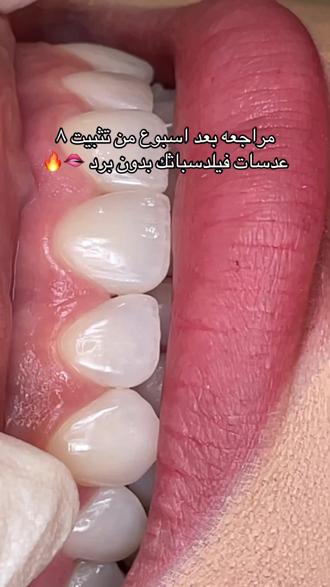 @Dr. Abrar Alhababi