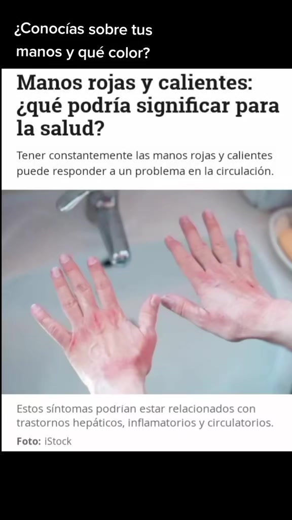 @Mirlehu
