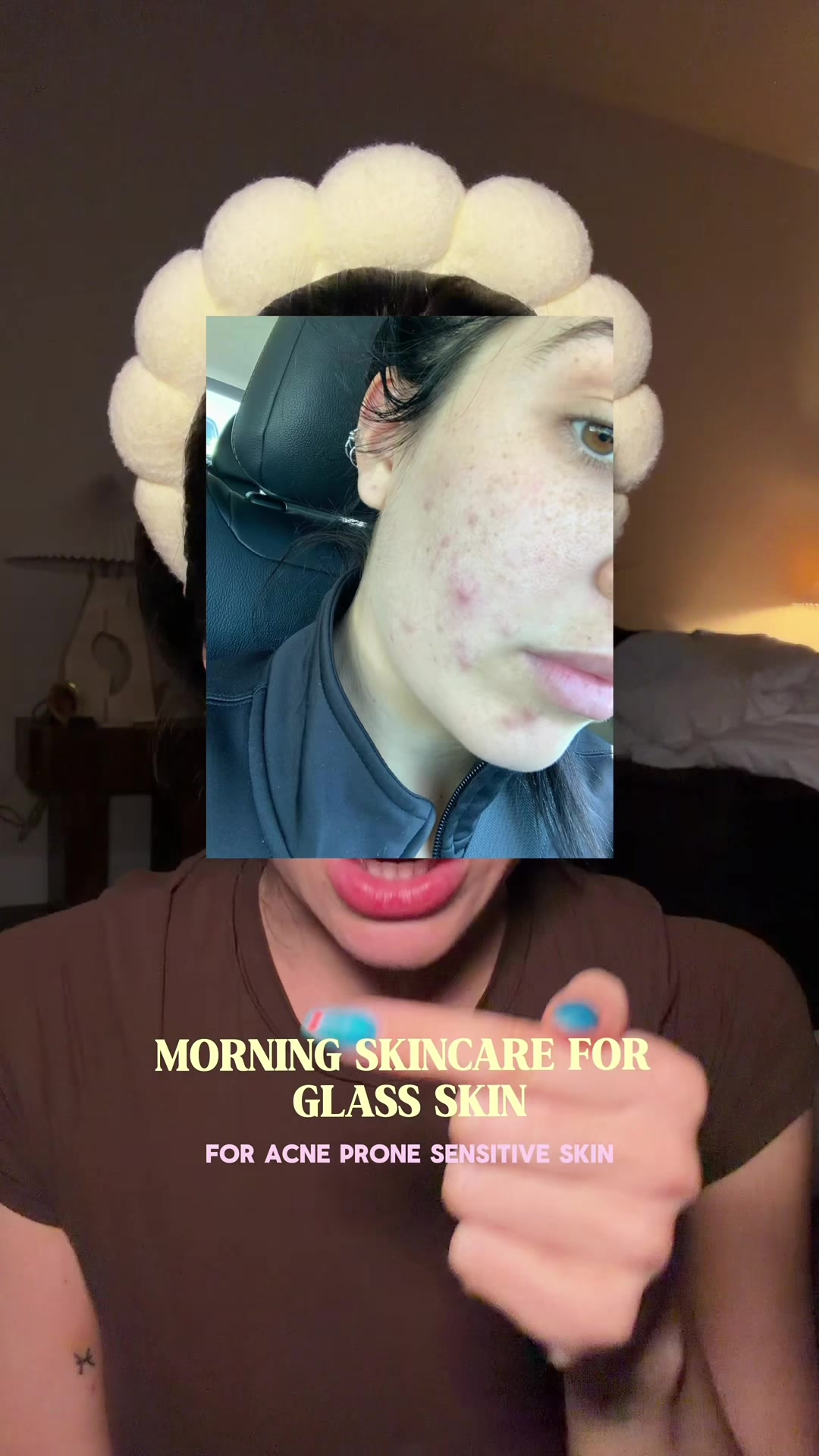 @blake vicknair