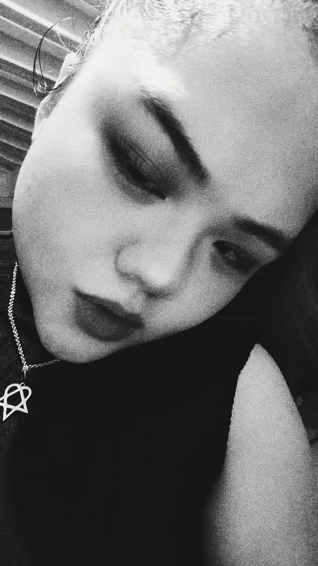 @Zamantha | The Strabismuse