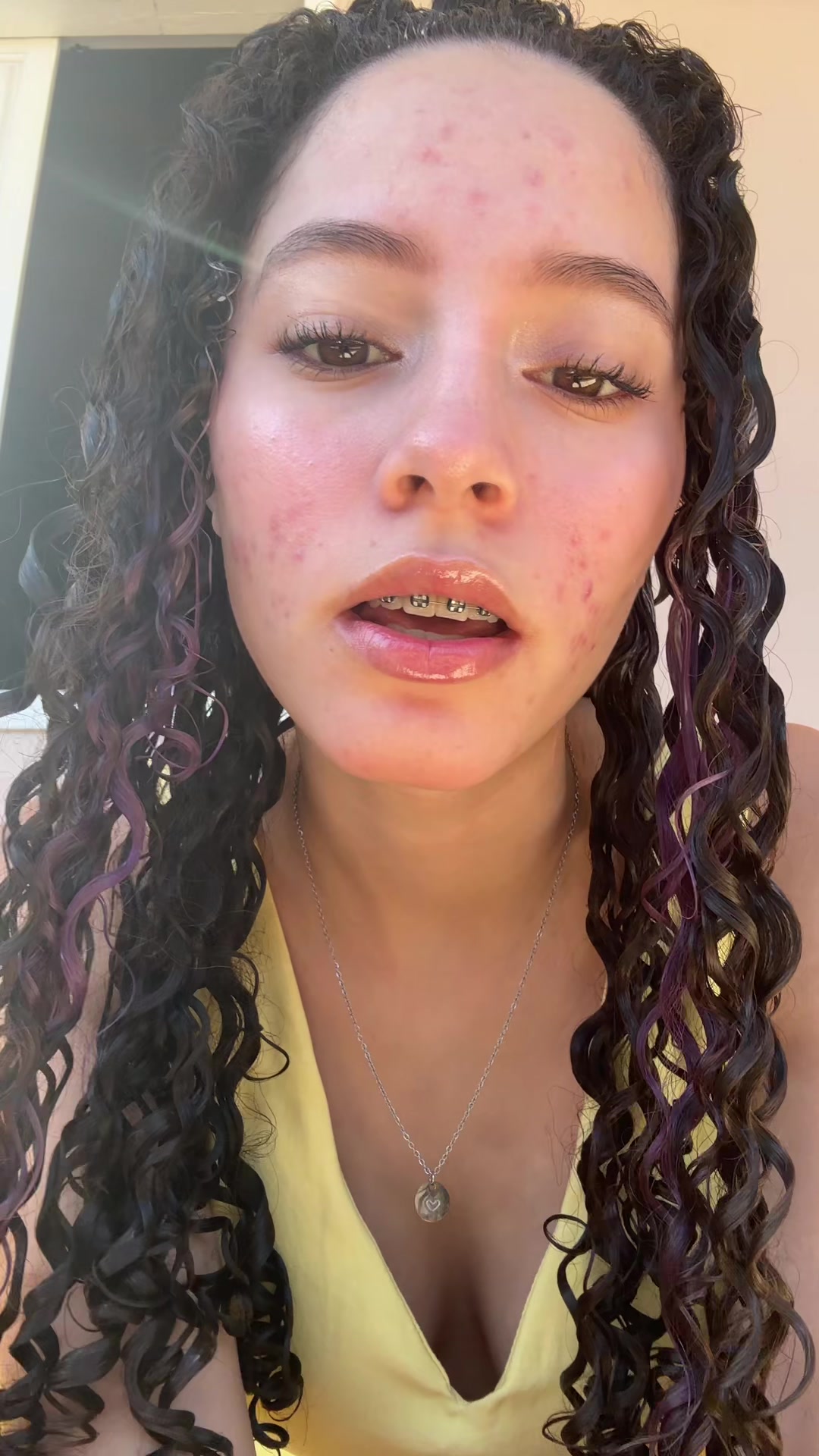 @Vivi
