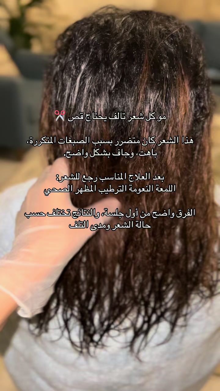 @أسماء | خبيرة معالجات الشعر🌷.