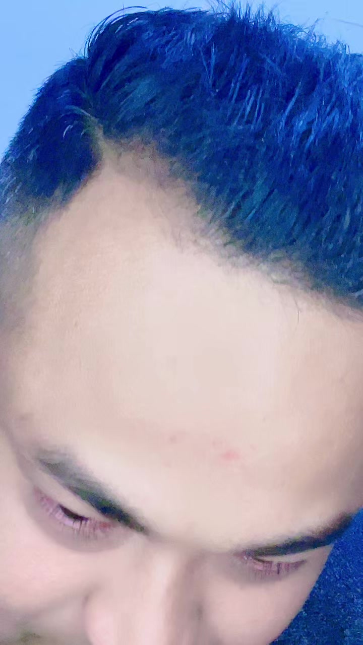 @Anup R.D🇳🇵♥️🇴🇲