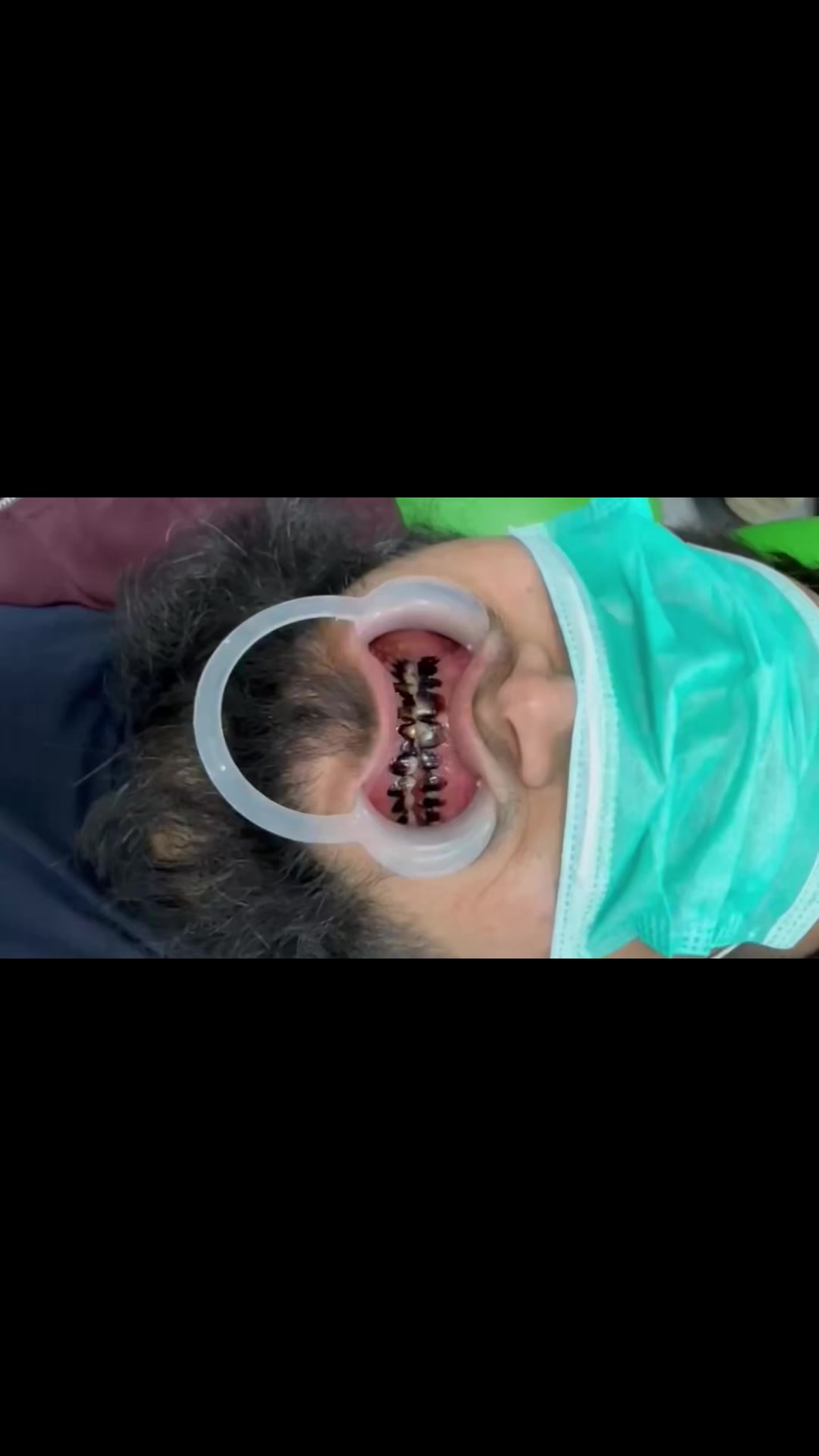 @Dr- syed numan official✅✅
