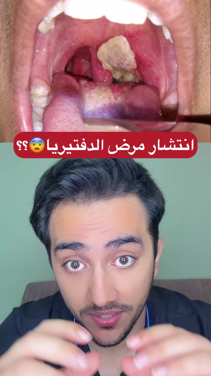 @Dr Ismail Aziz