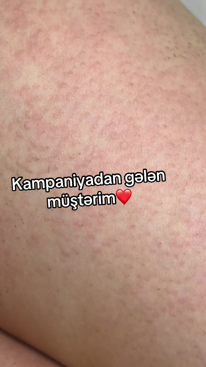 @jalelazeroloq