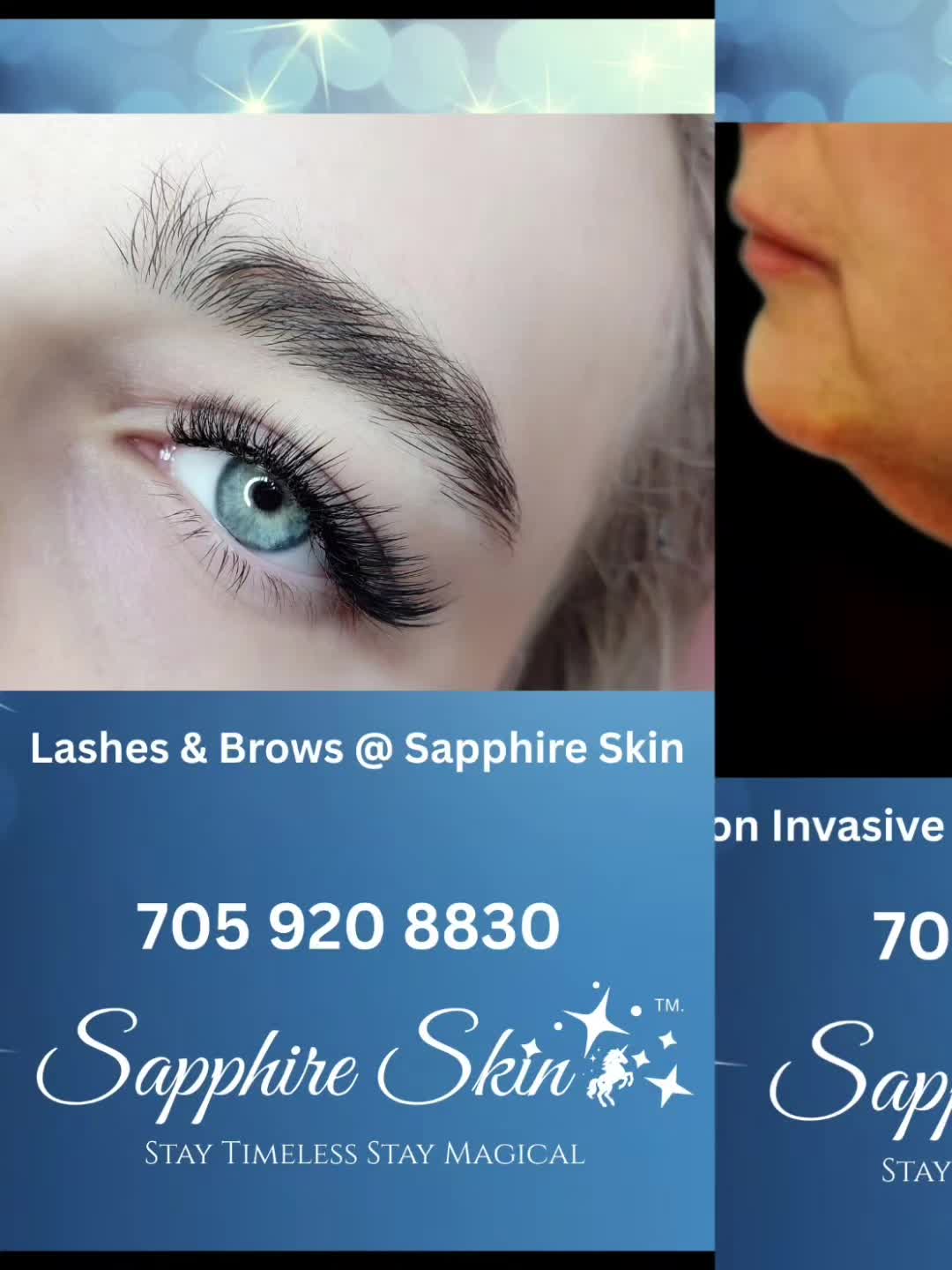 @Sapphire Skin