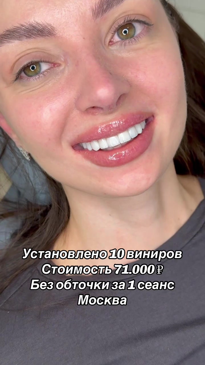 @Royal_smile_moscow