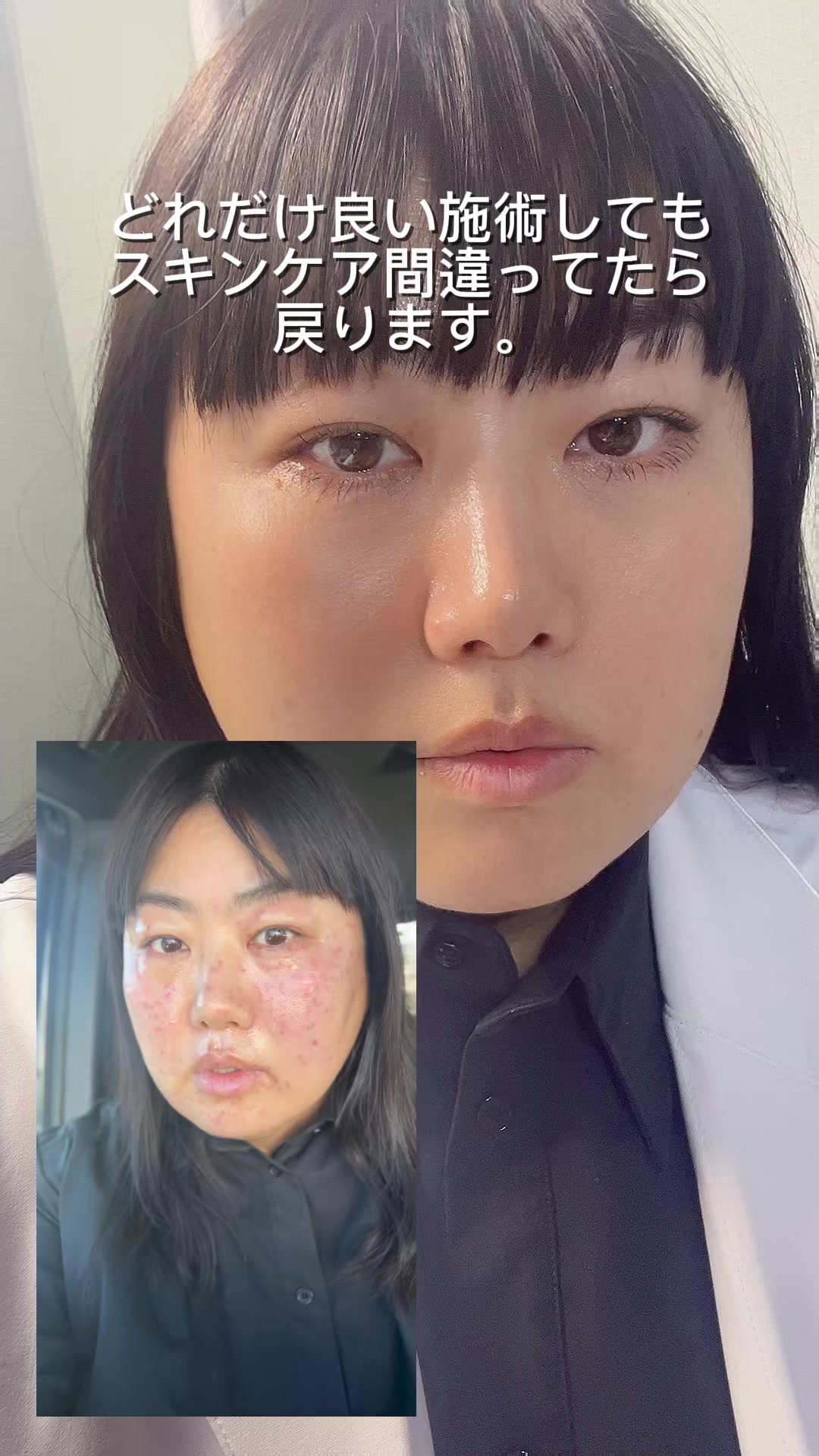 @HIROMI