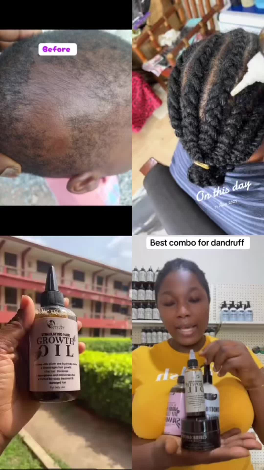 @NO.1HAIR GROWTH PRODUCTS