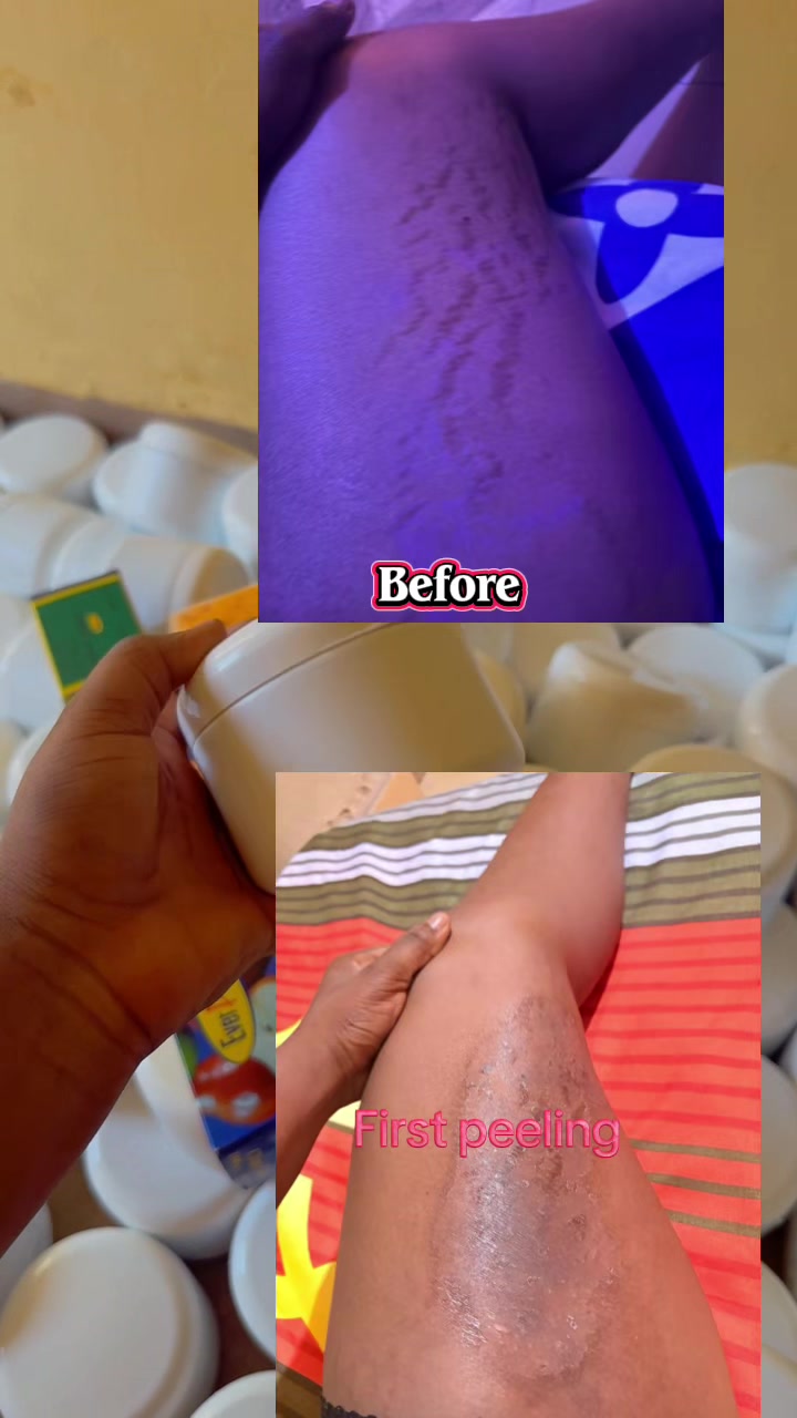@@ Precious peeling soap