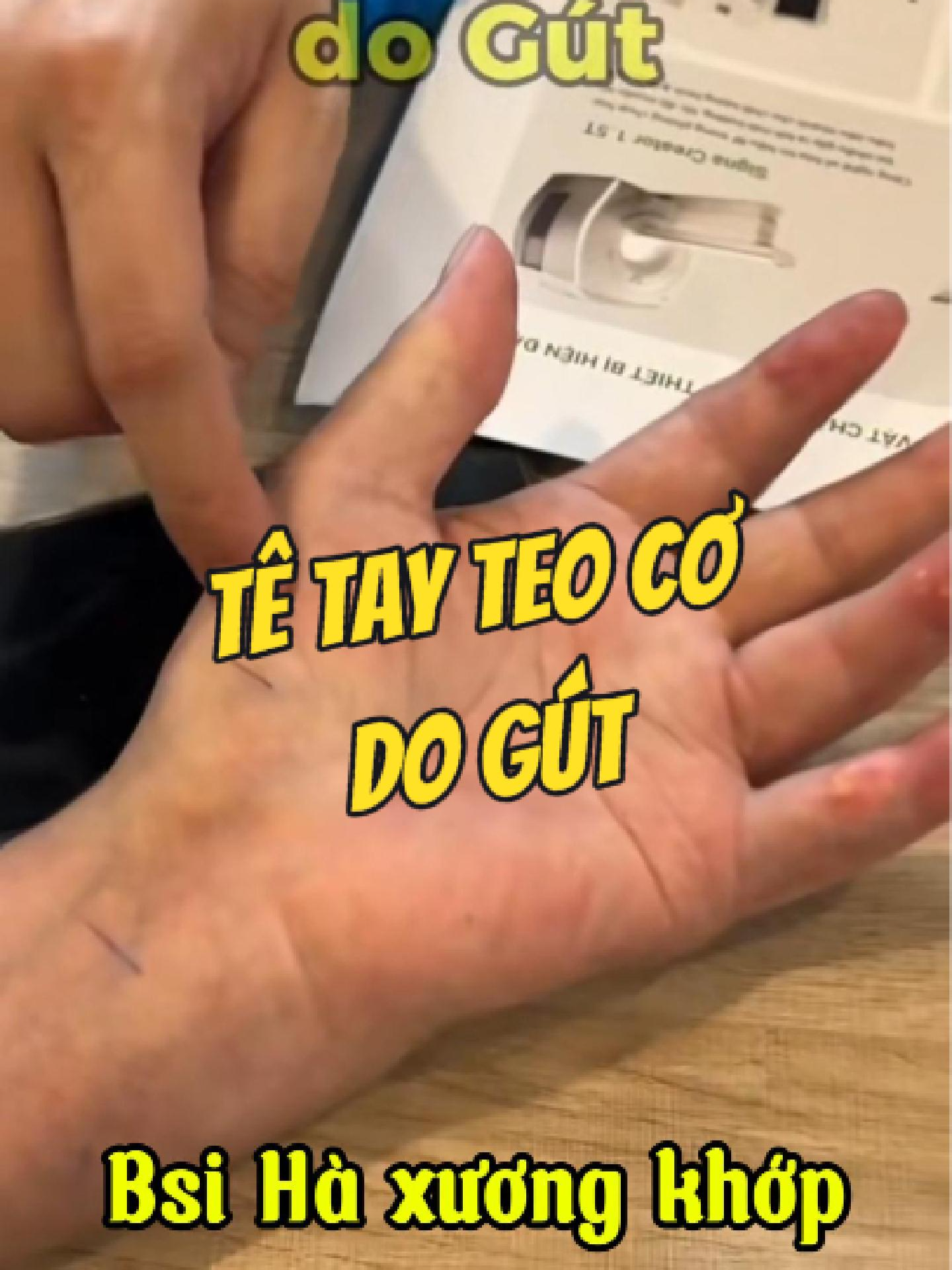 @Chuy&ecirc;n gia xương khớp