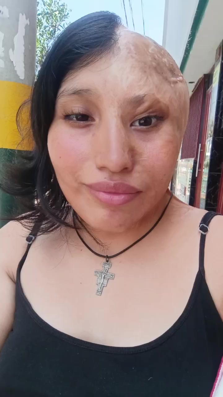 @Elizabeth Carri&oacute;n