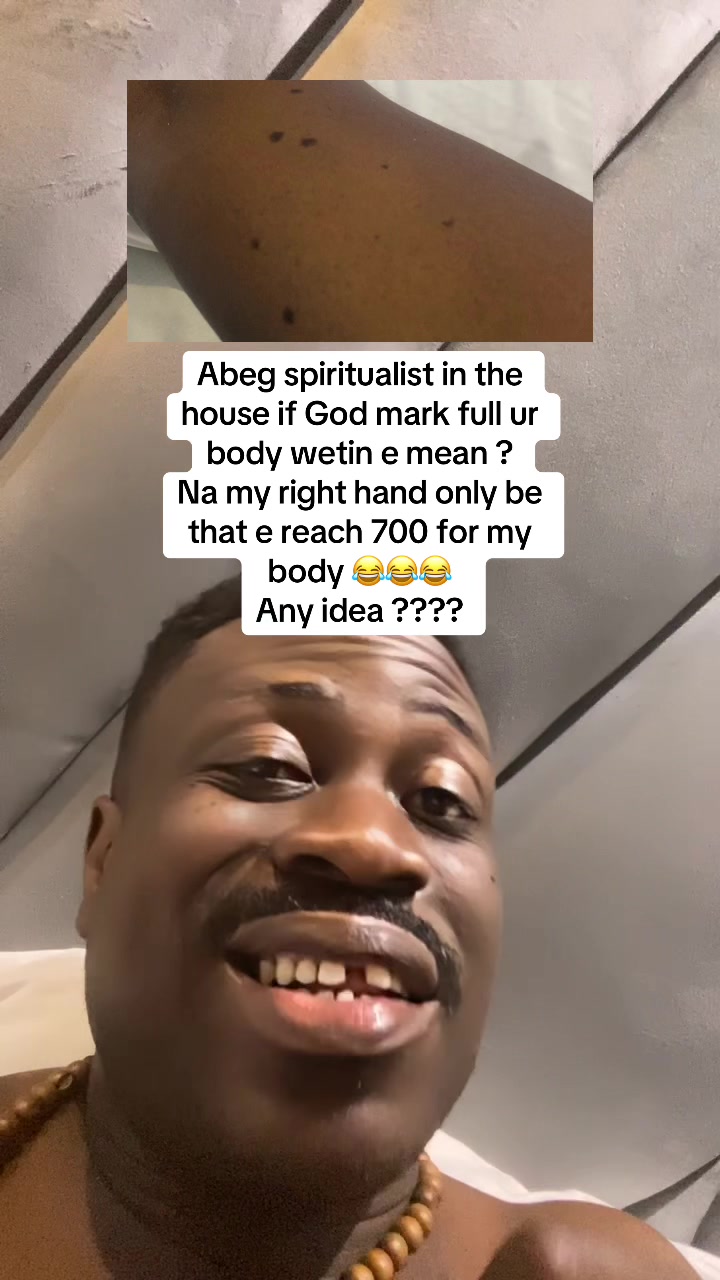 @GASKY 🦅🦷