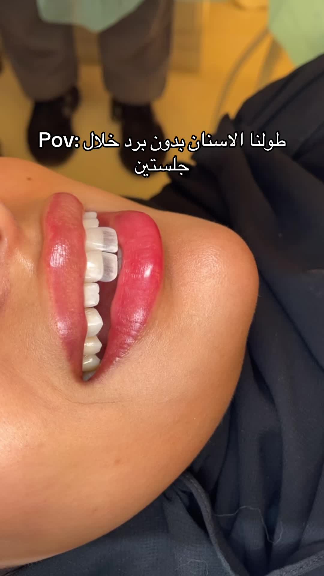 @Dr. Abrar Alhababi