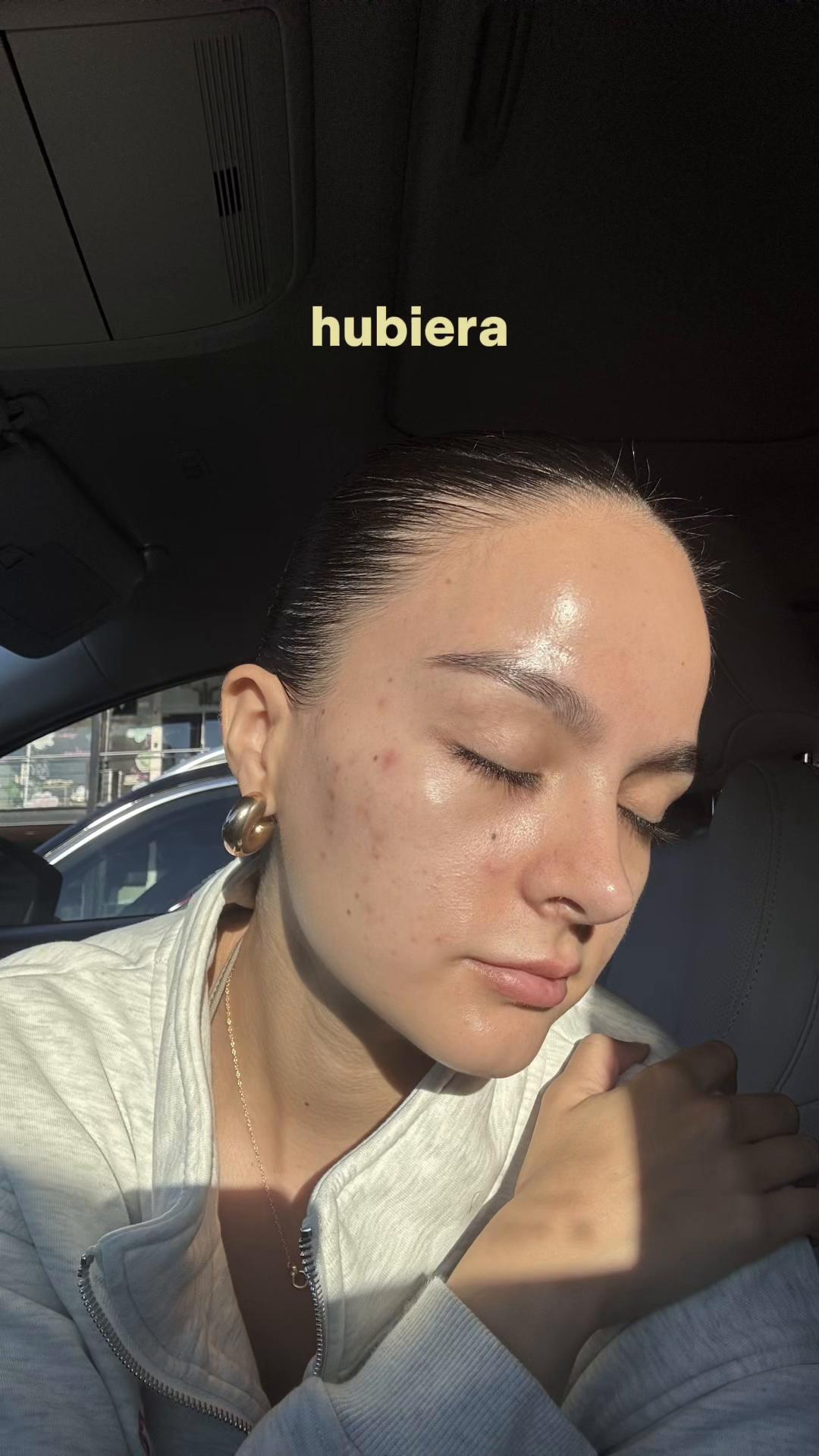 @Ale Trevi&ntilde;o