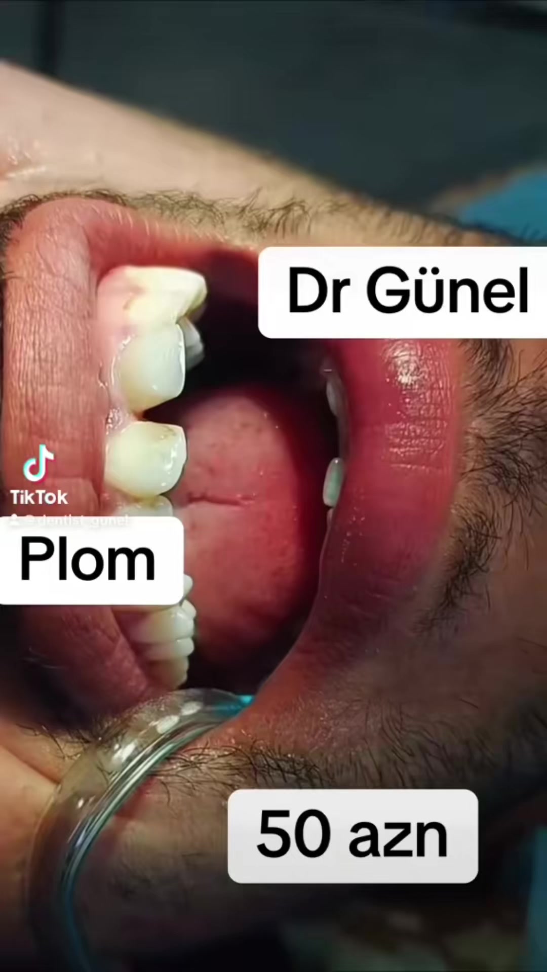 @Dentist_Günel