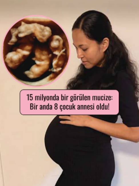 @Mynet Kadin