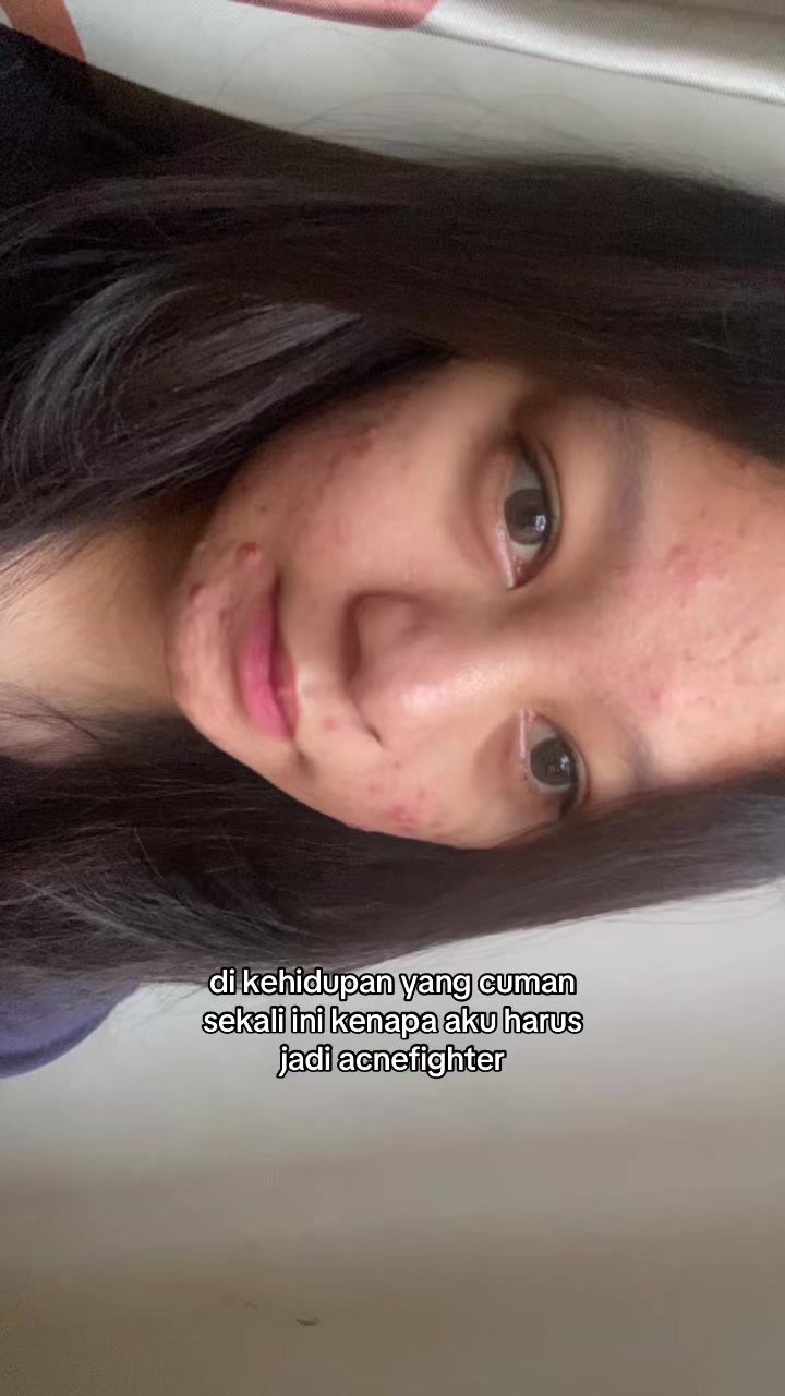 @chisin