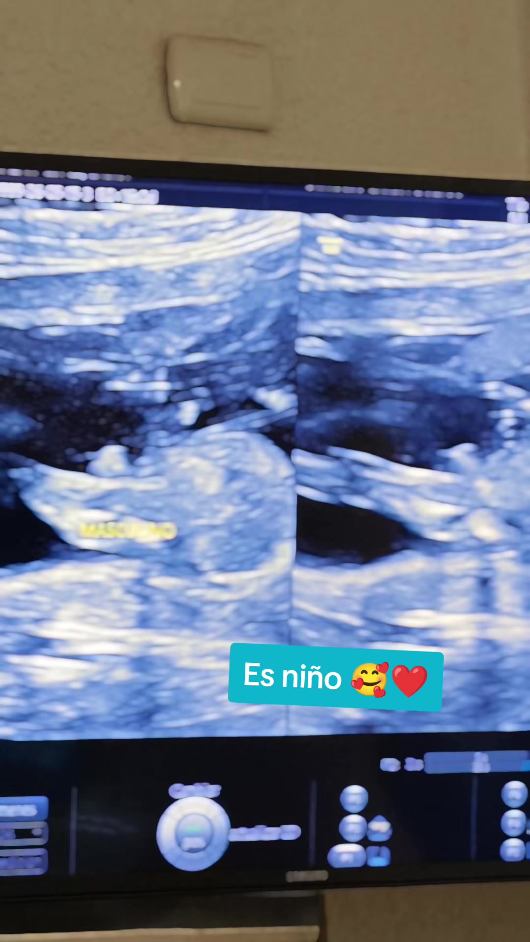 @oscarhernandezasesortoyo