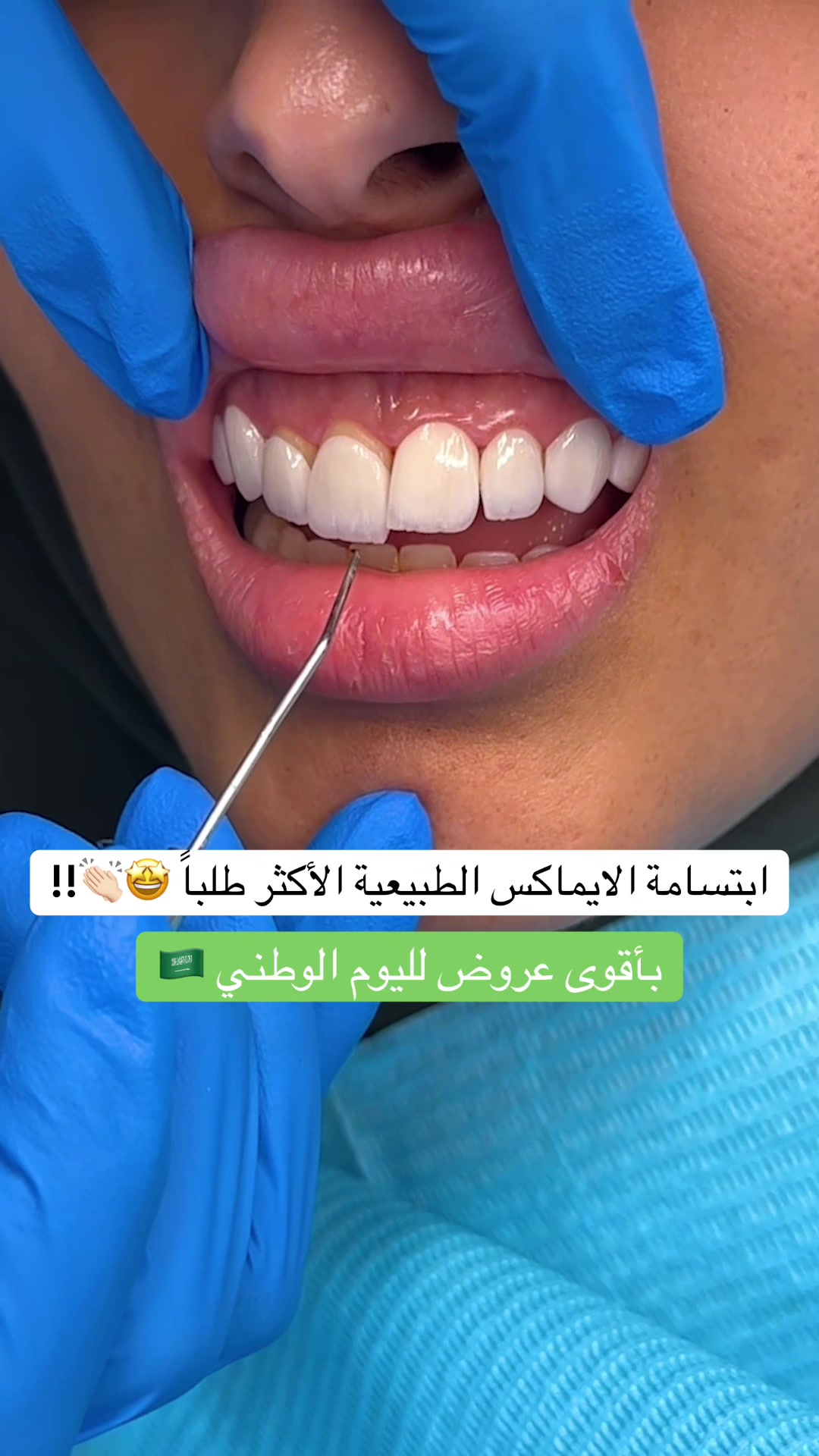 @عيادات البا للابتسامة