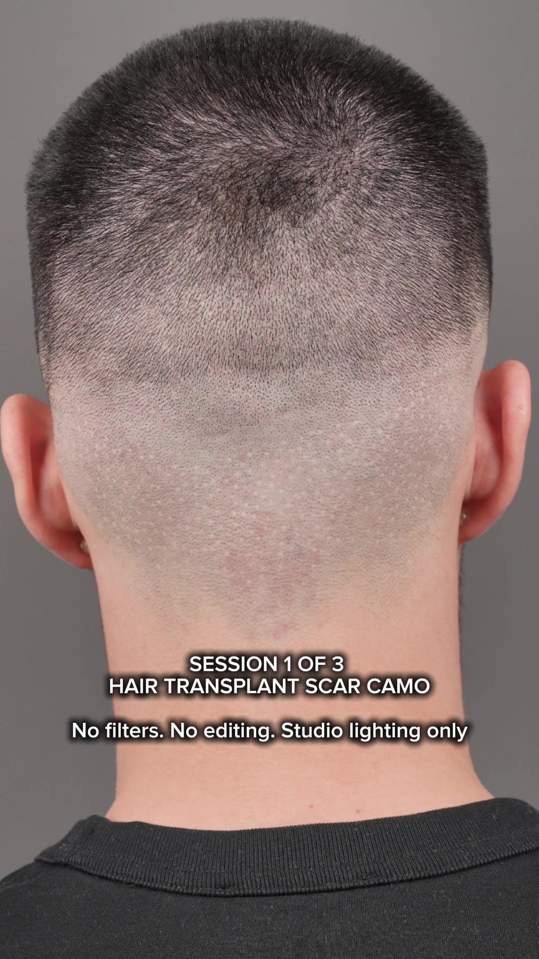 @Enhanced Scalp