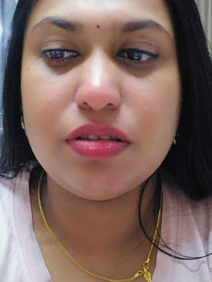 @✨EUPHORIA✨🇧🇭