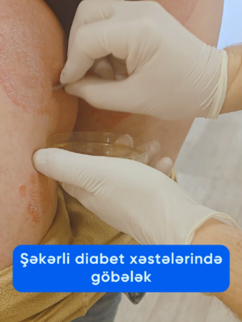 @Dr.Eldar Məmmədov