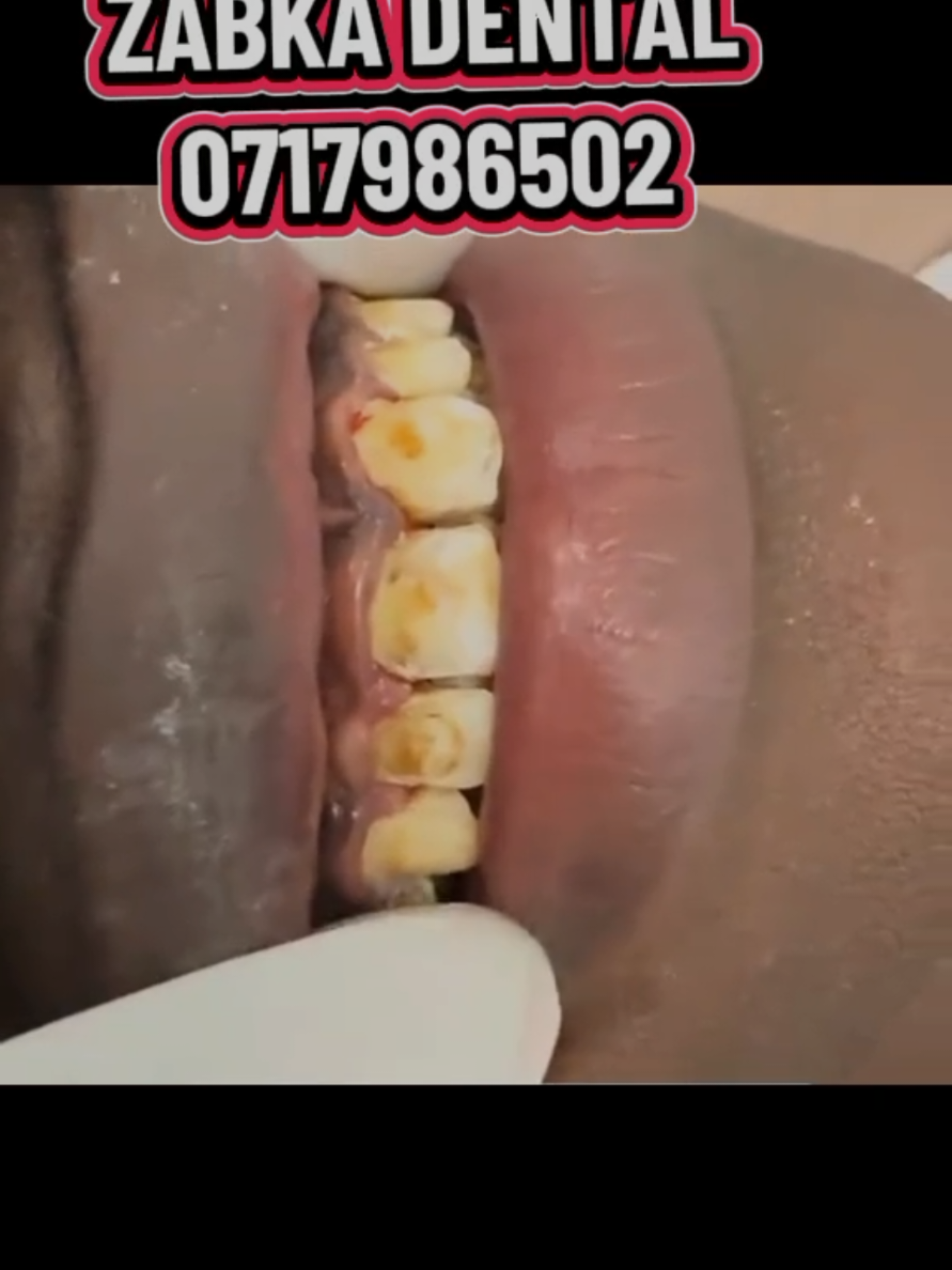 @Zabka Dental
